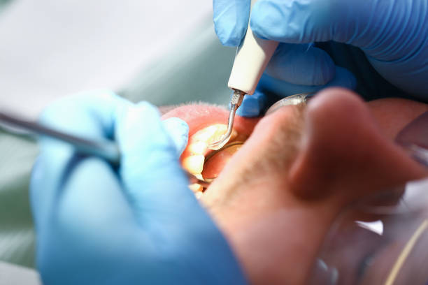 Best Same-Day Emergency Dentist in Druid Hills, GA