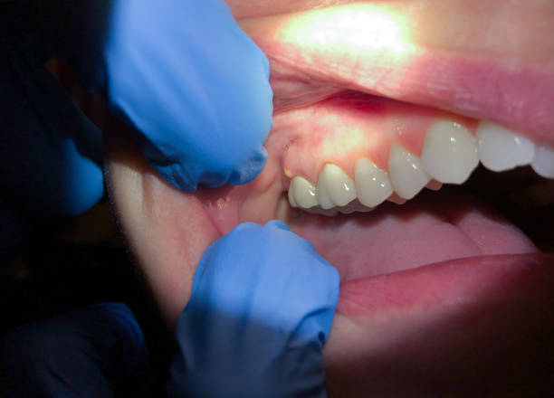 Best Emergency Dental Surgery in Druid Hills, GA
